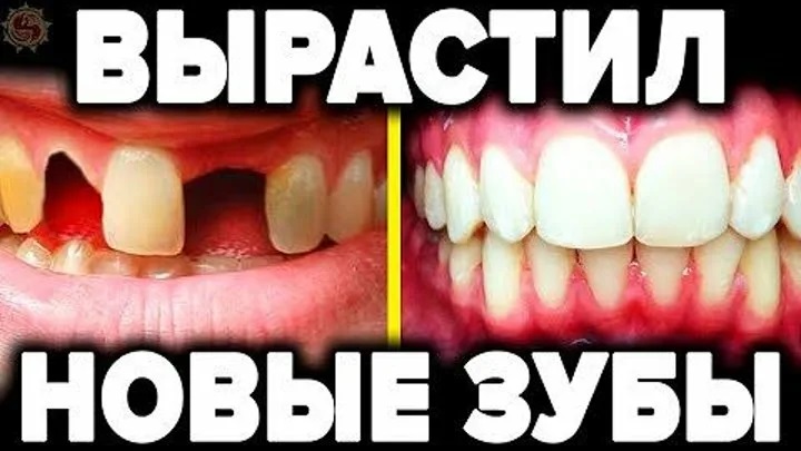 Выращивание зубов: Реальность или Миф?